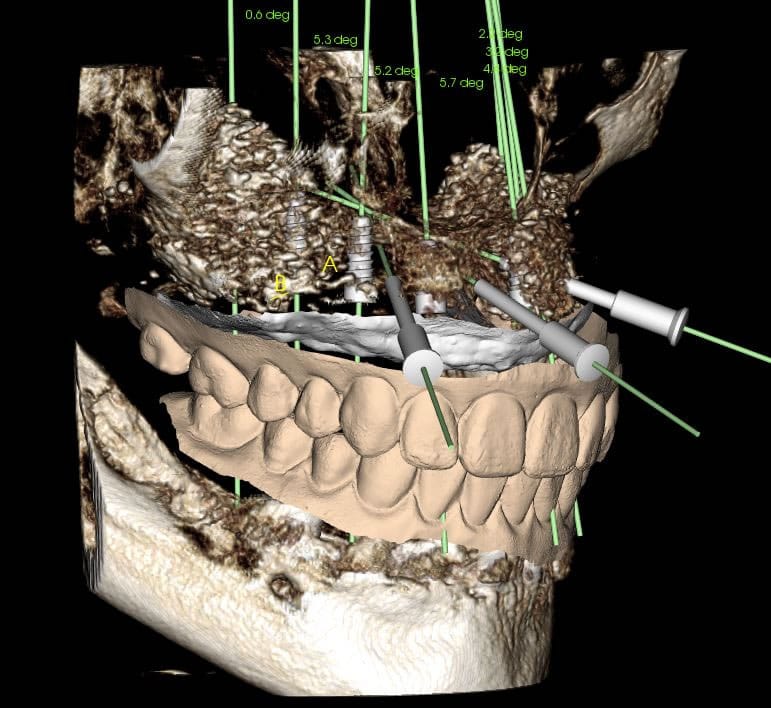 Computer generated dental technology